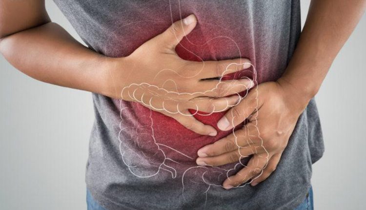 Colon irritable